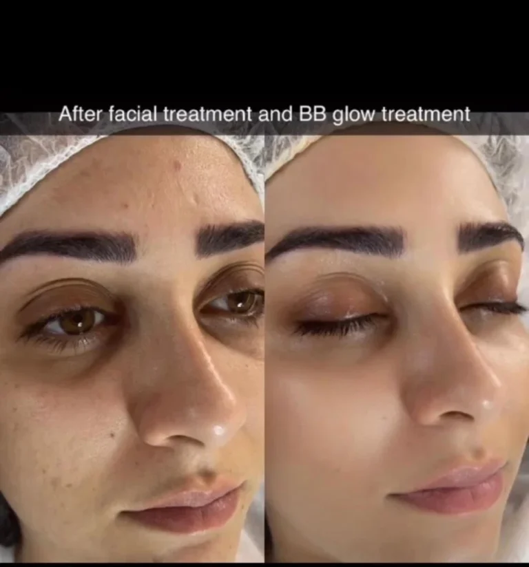 Sofia Makeovers Karnal facial 768x824